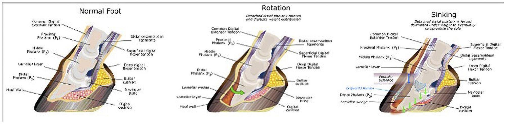 Illustration shows how laminitis develops in a horse's hoof.