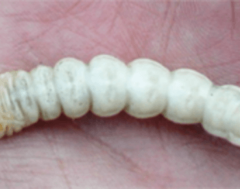 Image of roundheaded borer larvae